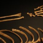 human bones laid out on a black background: a radius and ulna, wrist and hand, and ribcage